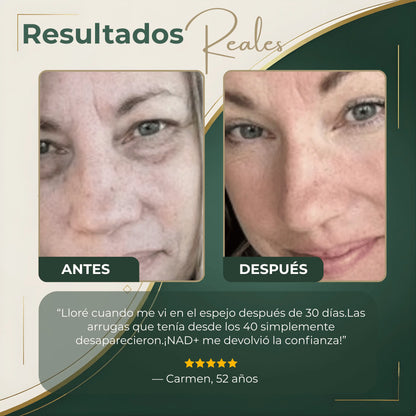 Tu Piel Más Firme y Radiante| NAD+ CELLULAR RESET™