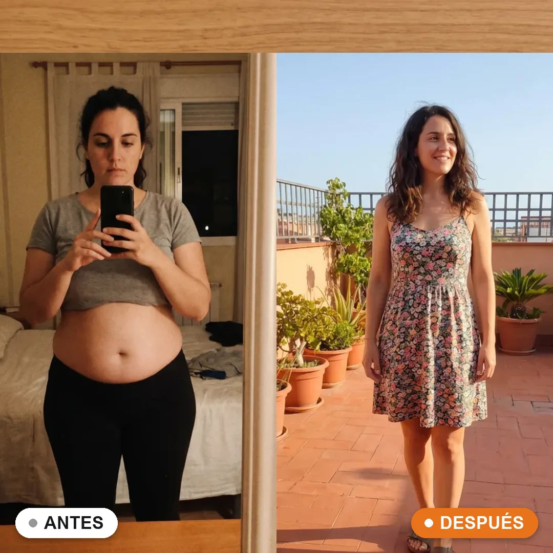 Antes y después Sàcia · Carmen, 43, Barcelona