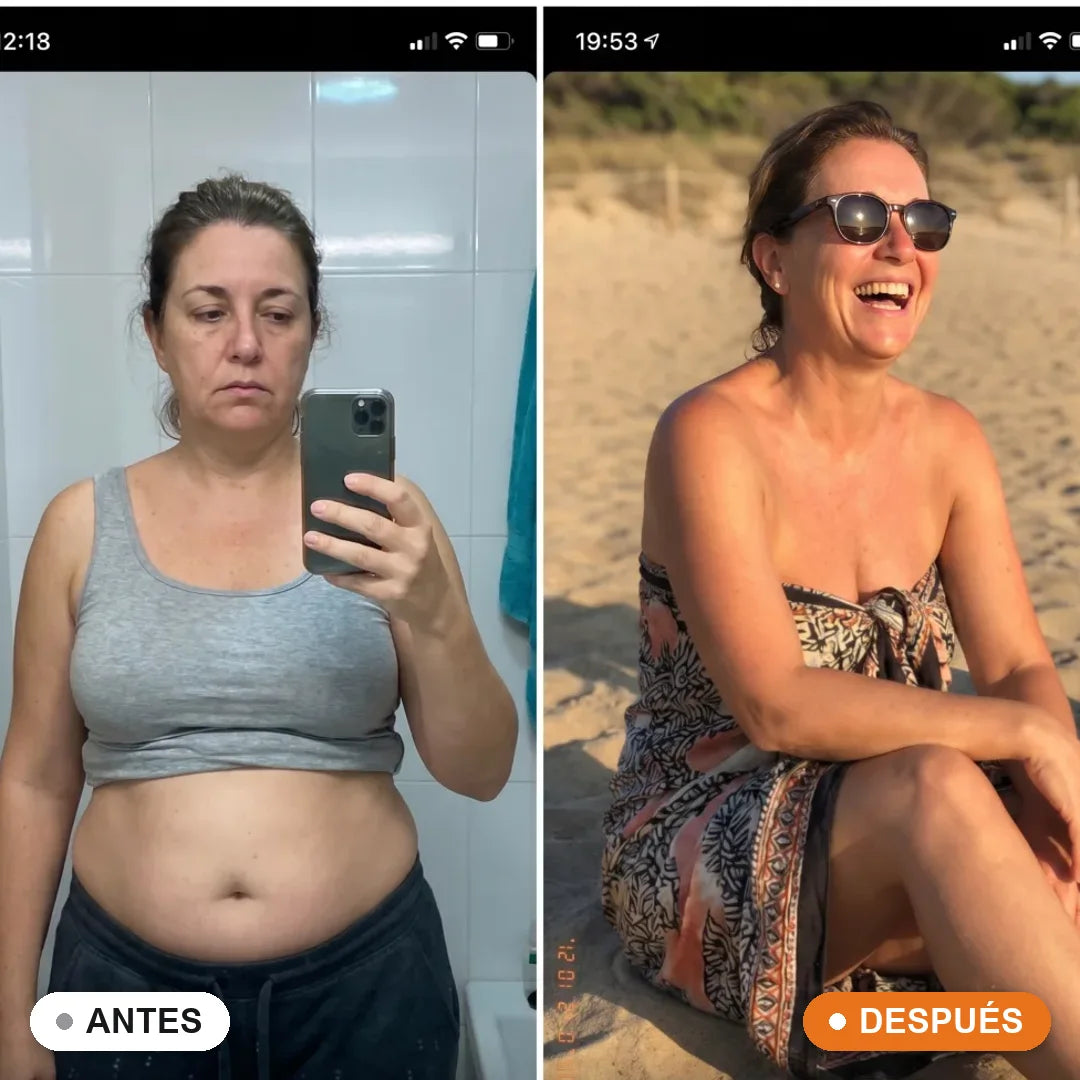 Antes y después Sàcia · Isabel, 44, Zaragoza