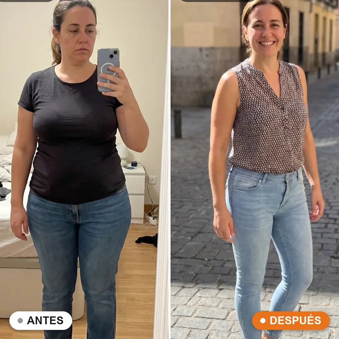 Antes y después Sàcia · Almudena, 41, Sevilla
