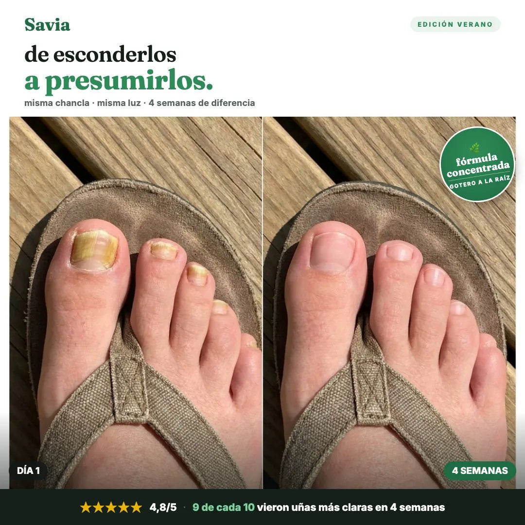 Antes y después de uñas de los pies con Savia